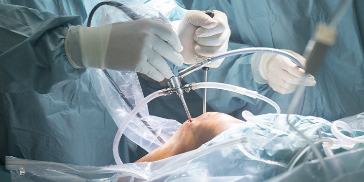 Joint replacement  procedures  services of milad hospital in khoy